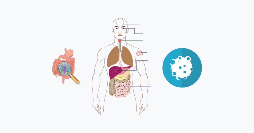 tumors